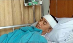 Agung Hercules Derita Kanker Otak Stadium 4