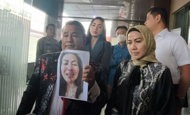 Besarnya Hasrat Seksual Ferry Irawan, Venna Melinda: Sentuh Organ Saya dengan Kasar, Ferry: Saya Mau Ini Susah Banget