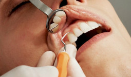 Bagaimana Merawat Kesehatan Gigi yang Baik dan Benar? Simak Penjelasan Berikut Ini!