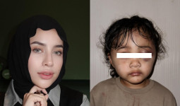 Kejam! Anak Selebgram Aghnia Punjabi Dianiaya Pengasuh, Mata Dipukul Berkali-kali Hingga Bengkak