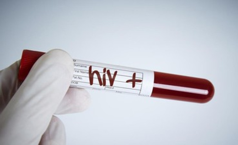 Lebih dari 2.000 Kasus HIV di Samarinda, Penyimpangan Seksual Jadi Masalah Utama