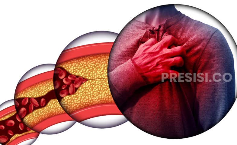 Atasi Sumbatan Pembuluh Darah Tanpa Operasi Besar: Kenali ABI dan Keunggulan PTA