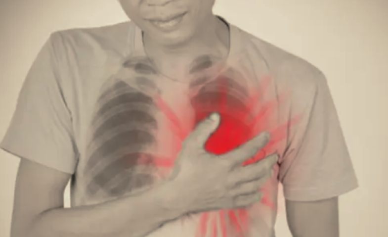 Mengenal Terapi ECP, Solusi Non-Bedah untuk Nyeri Dada dan Penyakit Jantung