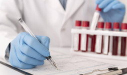 Pentingnya Tes Laboratorium dan Penyakit Jantung, Langkah Awal Deteksi Dini yang Presisi
