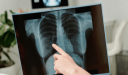 Peran Radiologi dalam Diagnosis dan Penanganan Penyakit Jantung