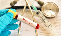 Terapi Stem Cell Dinilai Menjadi Solusi Inovatif bagi Kesehatan Jantung