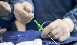 Tindakan Kateterisasi Masih Menjadi Primadona dalam Penanganan Penyakit Jantung