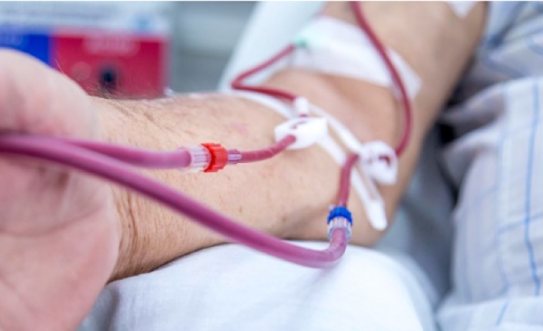 Menyimak Penjelasan Dokter Jantung Terkait Fungsi AV Shunt untuk Pasien Cuci Darah