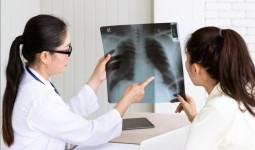 RSJPD Harapan Kita Hadirkan Layanan Poli Tuberkulosis untuk Mendukung Kesehatan Pasien Kardiovaskular